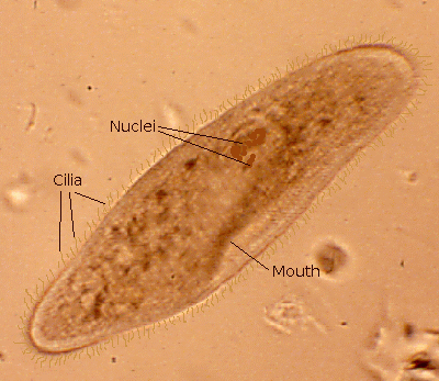 Description: Paramecium